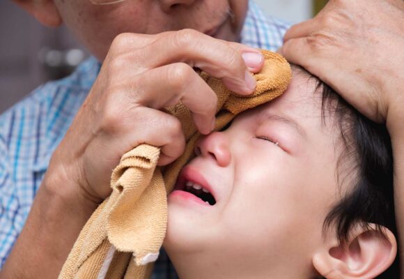 Consigli trauma cranico